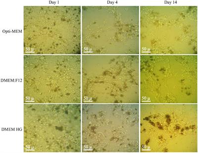 Correlation between metabolomic profile and proliferation of Macrobrachium rosenbergii primary embryonic cell culture